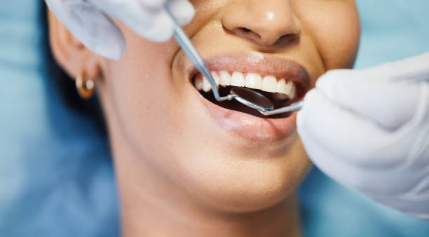 Best Emergency Wisdom Teeth Removal in Waimalu, HI