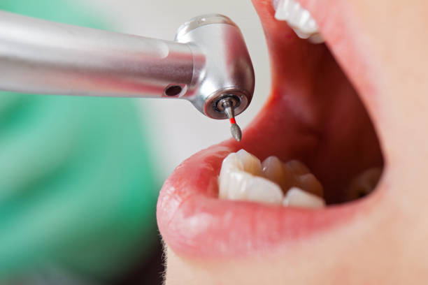 Best Pediatric Emergency Dentist in Waimalu, HI